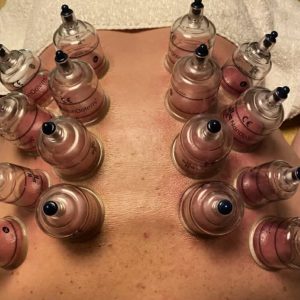 Cupping Massage 1 Beurt